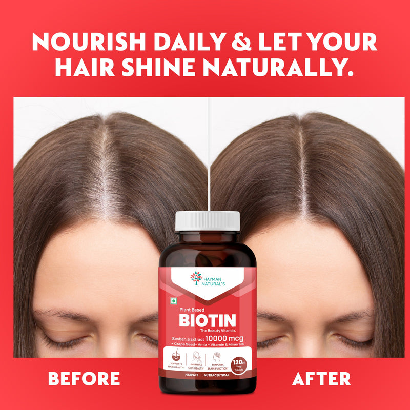 Hayman Natural's Plant Based Biotin Tablets | Sesbania Biotin with Amla & Grapeseed | Hair Vitamins for Men & Women for Hair Growth, Strong Hair, Skin & Nails | 120 Veg Tablets - 4 Months Supply